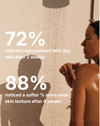 The SkinDose Filtered Showerhead