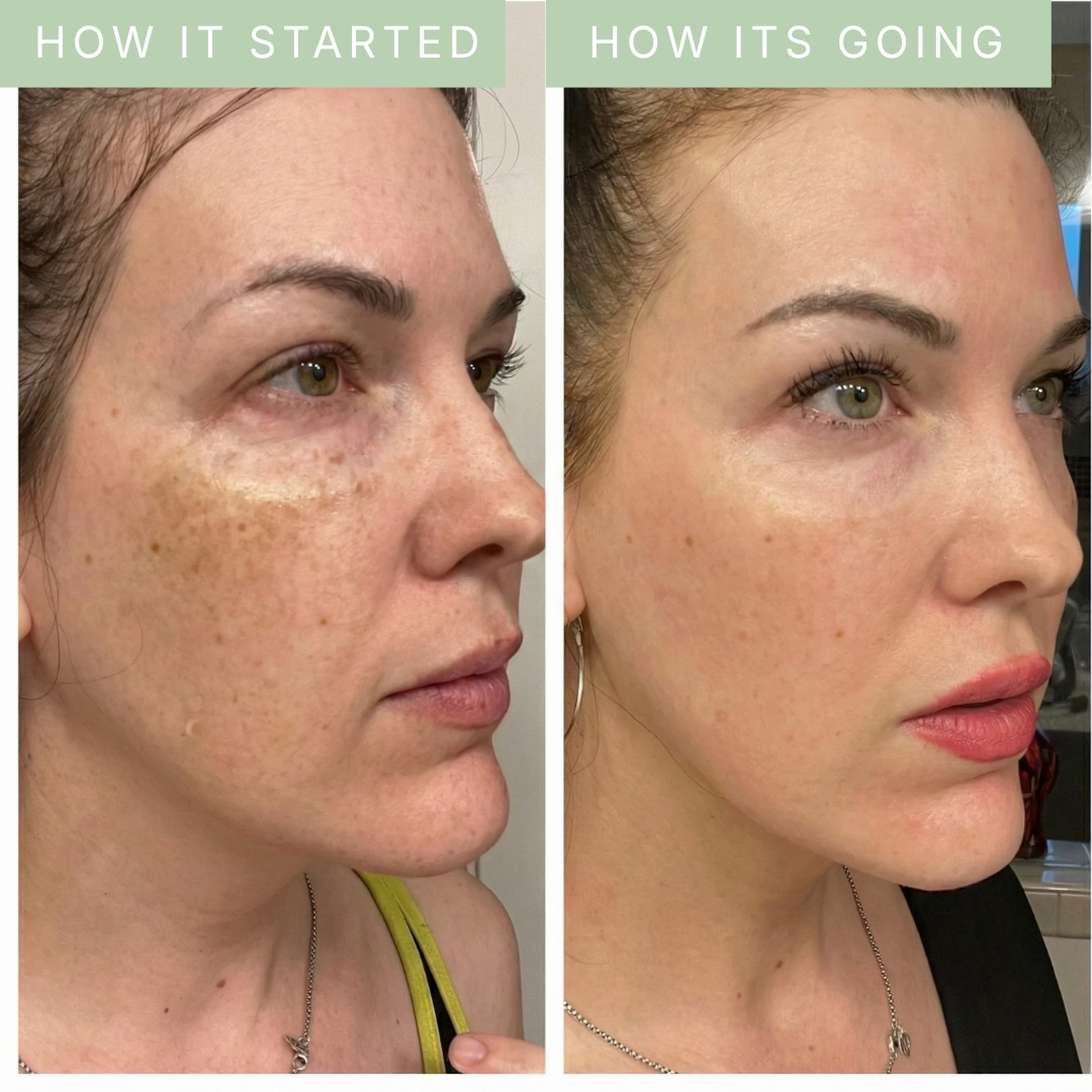 SkinDose Brightening Body Wash